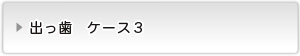出っ歯ケース３
