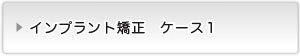 インプラント矯正ケース１