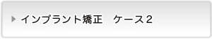 インプラント矯正ケース２