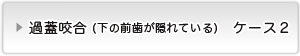 過蓋咬合ケース２