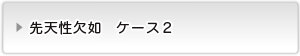 先天性欠如ケース２