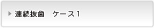 連続抜歯ケース１