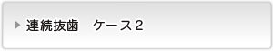 連続抜歯ケース２