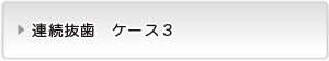 連続抜歯ケース３