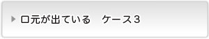 口元が出ているケース３