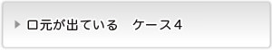 口元が出ているケース４