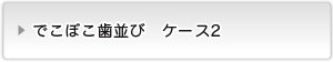 叢生ケース２