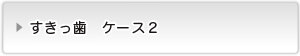 すきっ歯ケース２