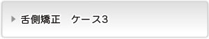 見えない矯正ボタン３