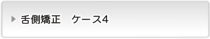 見えない矯正ボタン４