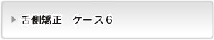 見えない矯正ボタン６