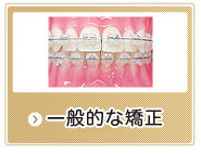 一般的な矯正