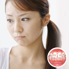 私の悩み口元が出ている