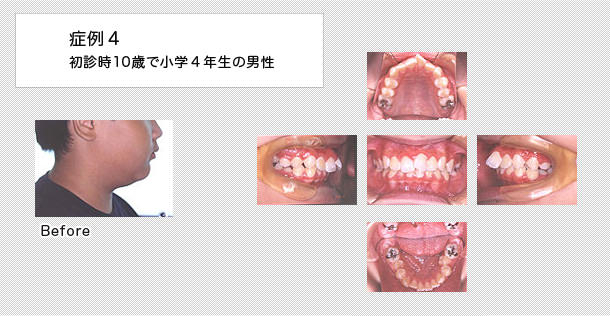 10歳で小学校4年生の男の子