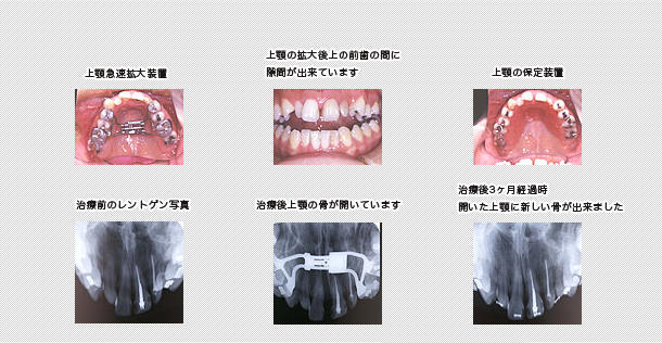 治療経過とレントゲン写真