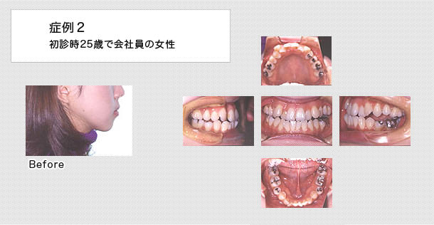 25歳で会社員の女性の症例