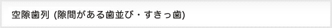 空隙歯列、隙間がある歯並び、すきっ歯