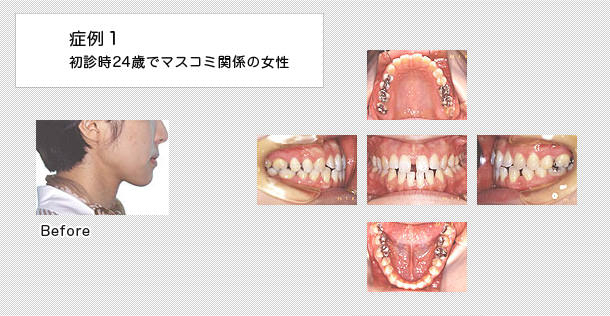 24歳マスコミ関係の女性の症例