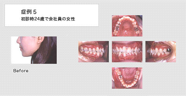 24歳で会社員の女性の症例