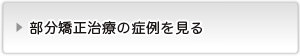 部分矯正の症例を見る