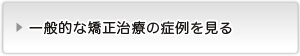 一般的な矯正治療の症例を見る