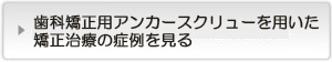 インプラント矯正治療の症例を見る