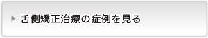 舌側矯正の症例を見る