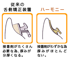 舌側矯正で使用する装置